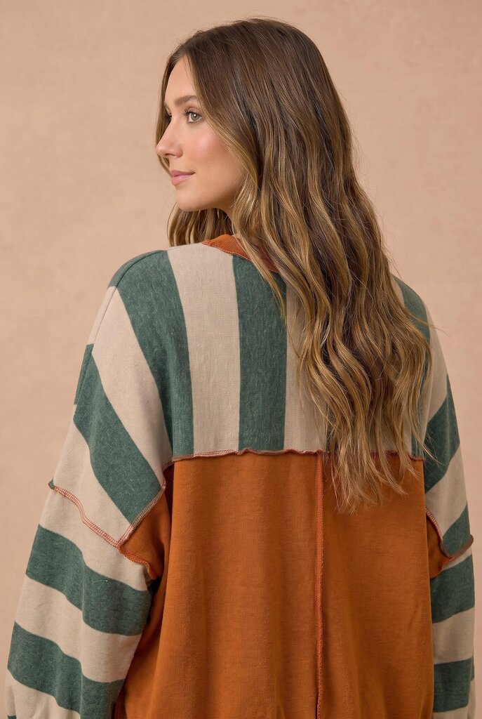 Oversized Striped Top